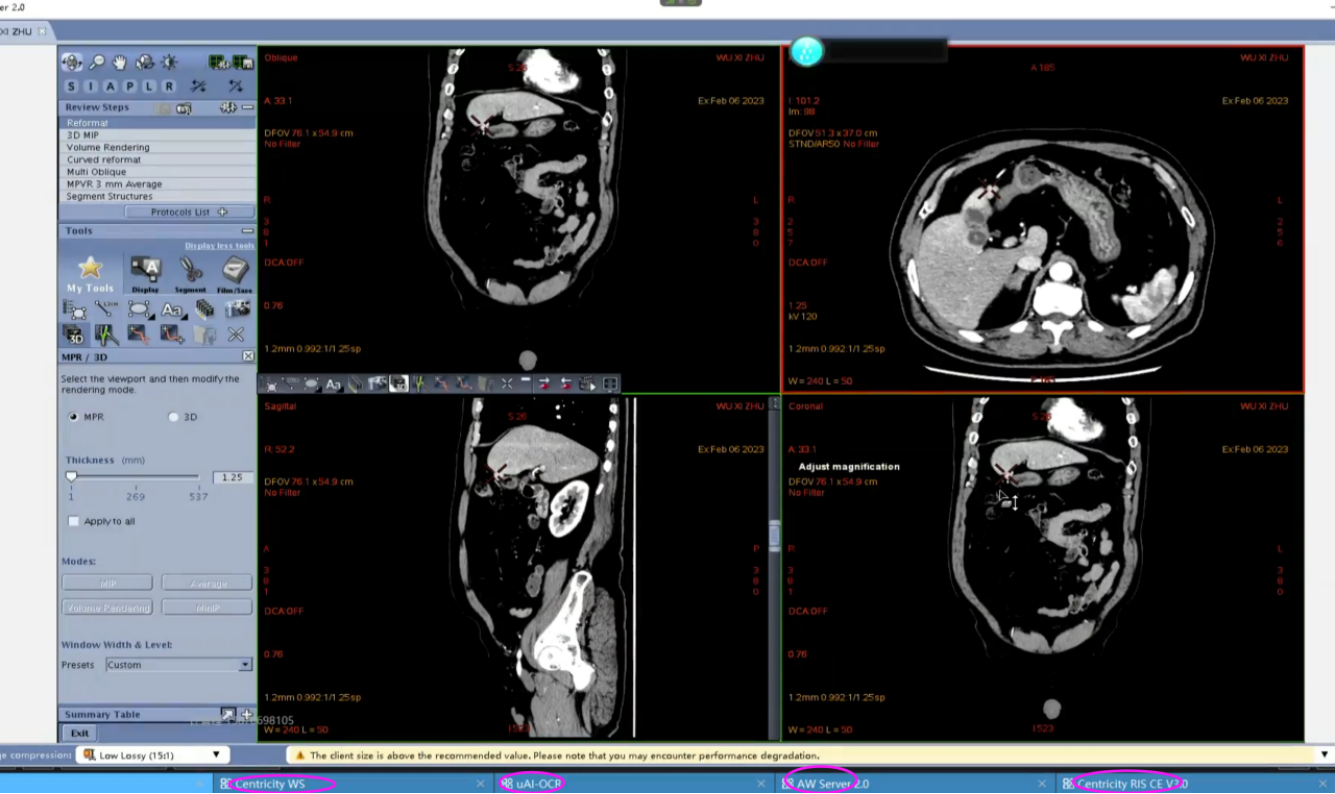 ddfc1218f8552bd1553c11db5fc6c083.png ddfc1218f8552bd1553c11db5fc6c083.png